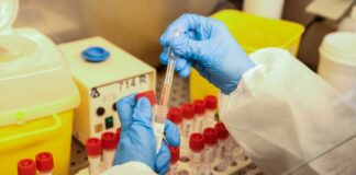 Covid, a Malta il più alto tasso di decessi in Europa