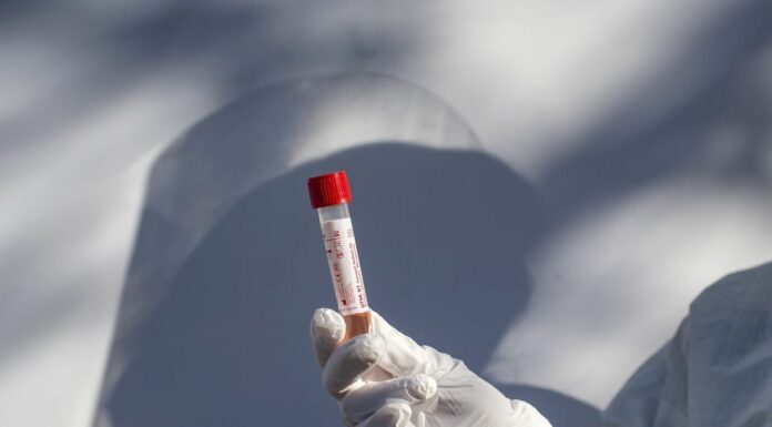 Covid, in salita l’incidenza settimanale, in calo le intensive