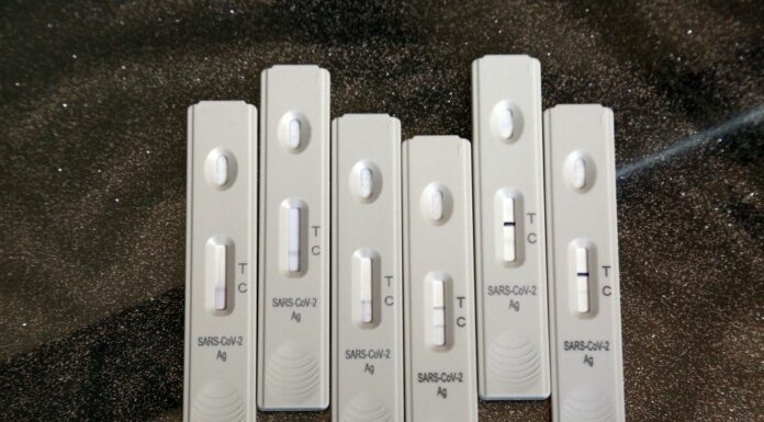 Covid, In Italia 24.855 contagi e 80 decessi