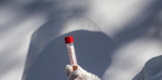 In Sardegna 215 nuovi positivi e un decesso