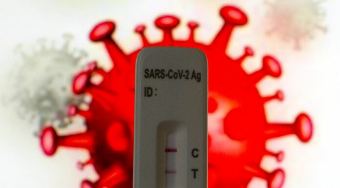 Covid, 33.876 nuovi casi positivi e 38 decessi