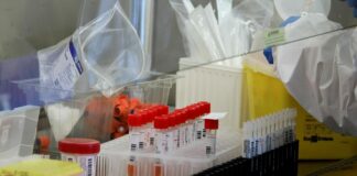 In Sicilia 532 nuovi casi di Covid e 1 vittima