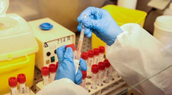 Il bollettino dei dati Covid diventa settimanale