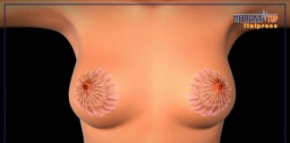 Tumore al seno, la sopravvivenza a 5 anni dalla diagnosi è dell’88%