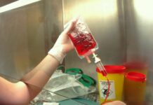 Malattie del sangue, quando la ricerca va di pari passo alla cura