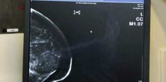 Tumore al seno, Fda approva un nuovo farmaco di Menarini