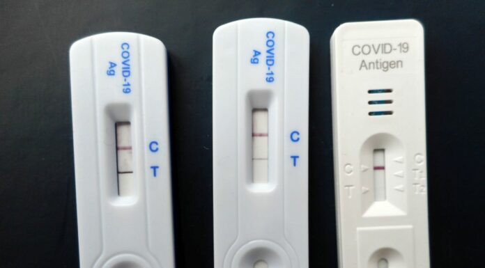 Covid, 29.433 nuovi positivi e 244 decessi nell’ultima settimana