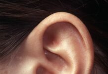 World Hearing Day, nel mondo 1 persona su 5 soffre di un calo dell’udito