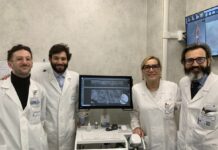 Tumori della pelle, al Gemelli biopsia virtuale per la diagnosi precoce