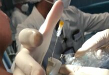 Policlinico di Palermo, cellule staminali per rigenerare tendini e articolazioni