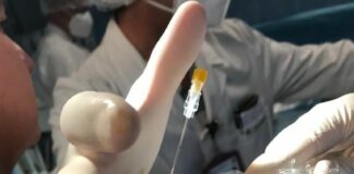 Policlinico di Palermo, cellule staminali per rigenerare tendini e articolazioni