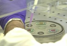 Da terapia ultrasonica effetti anti-infiammatori sui macrofagi