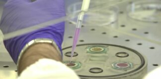 Da terapia ultrasonica effetti anti-infiammatori sui macrofagi