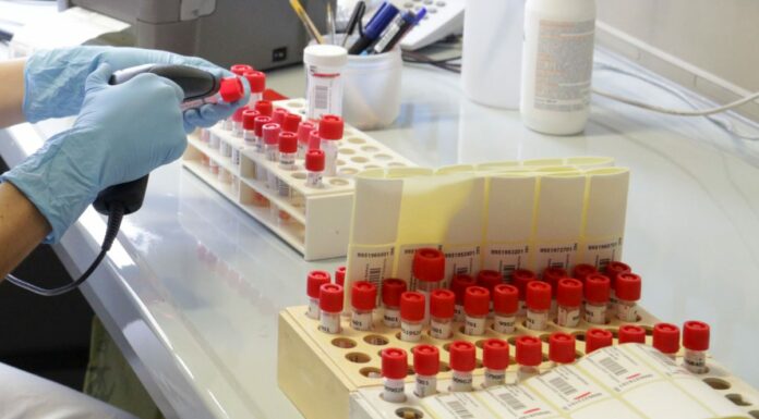 Malattie sessualmente trasmissibili +30% nella fase post Covid