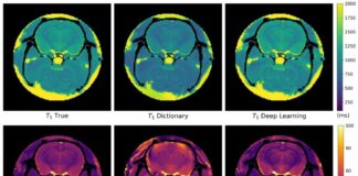 Con intelligenza artificiale lettura risonanza magnetica in 10 secondi