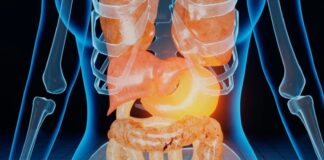 Calcoli alla colecisti, ittero e pancreatite i pericoli maggiori