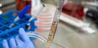 Sanofi, nuovo anticorpo riduce la progressione della sclerosi multipla