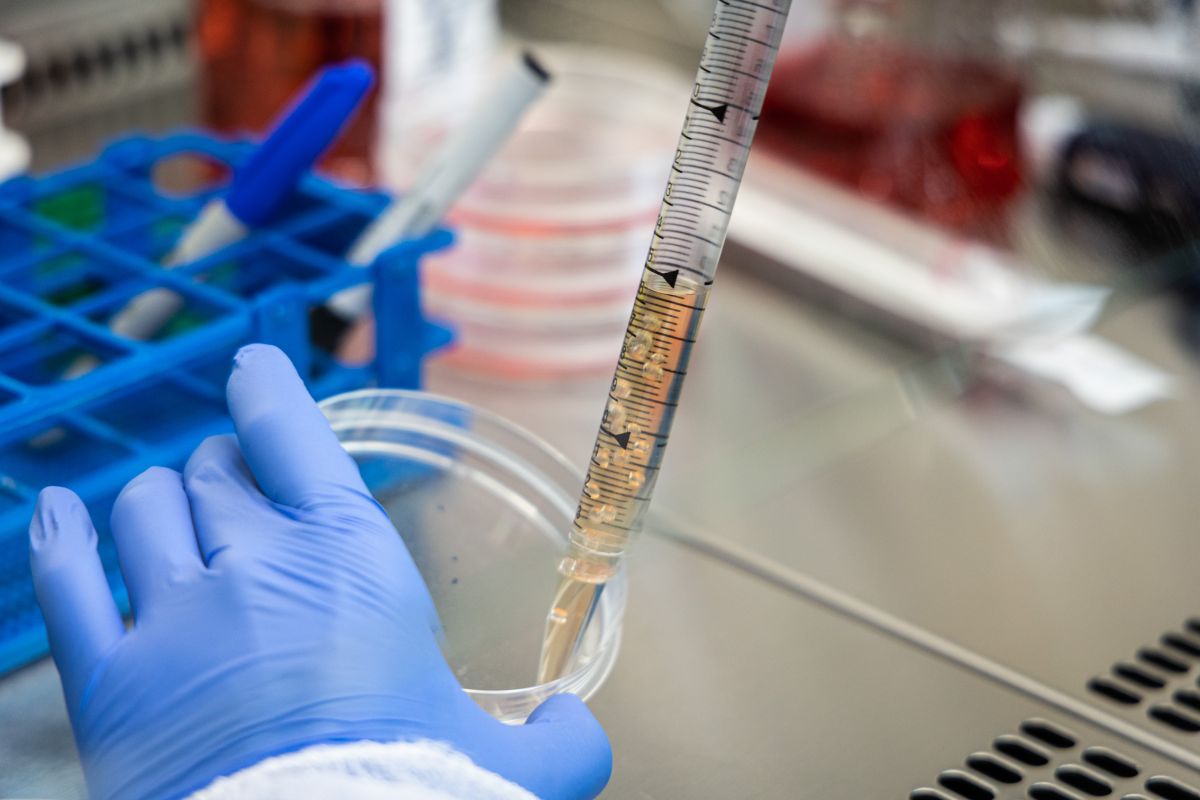 Sanofi, nuovo anticorpo riduce la progressione della sclerosi multipla Sanofi, nuovo anticorpo riduce la progressione della sclerosi multipla
