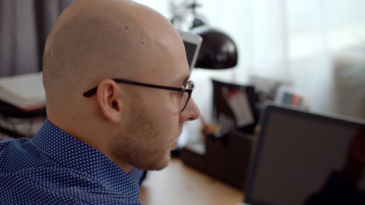Alopecia, in Italia colpisce 4 uomini su 10. Il trapianto una soluzione Alopecia, in Italia colpisce 4 uomini su 10. Il trapianto una soluzione
