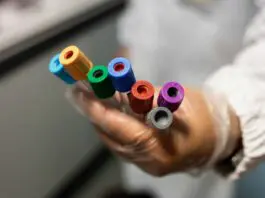 Pubblicato un studio preclinico sull’Indolo-3-Carbinolo contro l’infezione da SARS-CoV-2