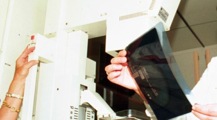 Tumore al seno, i test genomici rafforzano i percorsi di cura