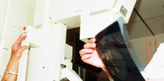 Tumore al seno, i test genomici rafforzano i percorsi di cura