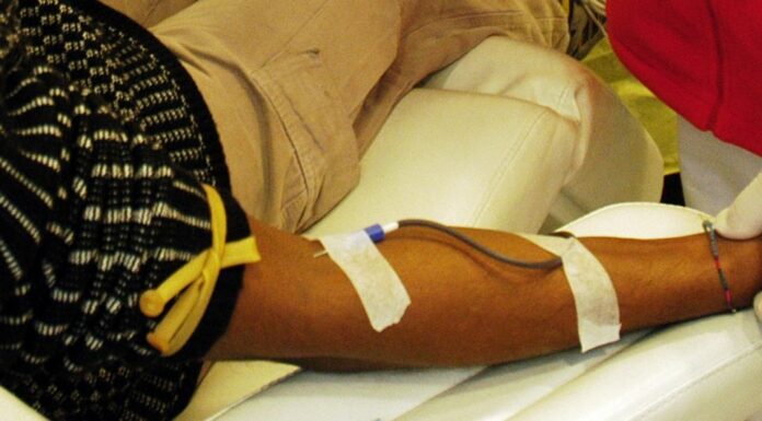 Emergenza plasma, Segato (Aip) “Servono campagne per la donazione”