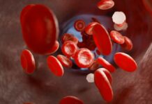 Trombosi alla base di gravi malattie, in Italia 600.000 ogni anno