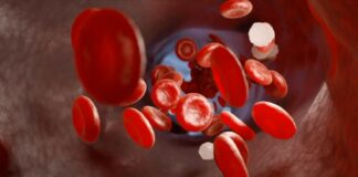 Trombosi alla base di gravi malattie, in Italia 600.000 ogni anno