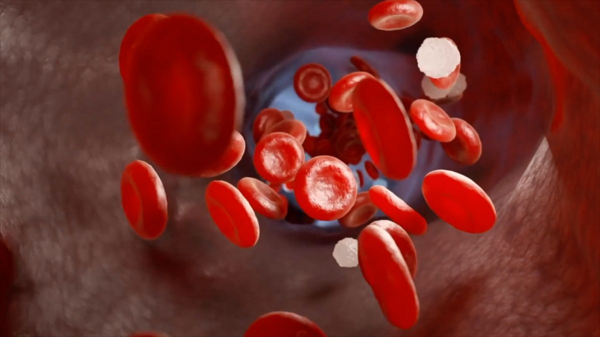 Trombosi alla base di gravi malattie, in Italia 600.000 ogni anno Trombosi alla base di gravi malattie, in Italia 600.000 ogni anno