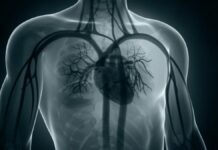 Tumore ai polmoni, ripresa più rapida grazie alla chirurgia robotica