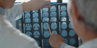 Tumori al cervello, grandi passi avanti nella neurochirurgia