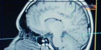 Ultrasuoni focalizzati, alta tecnologia al servizio della neurochirurgia