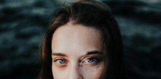 Vitiligine, arriva in Italia il primo trattamento specifico