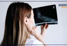 Riconoscere una frattura e l’importanza del giusto trattamento