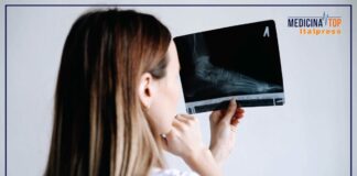 Riconoscere una frattura e l’importanza del giusto trattamento