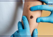 Passi avanti nella cura del melanoma, presto il vaccino