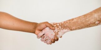 Malattie della pelle, Salutequità “Più programmazione e reti dedicate”