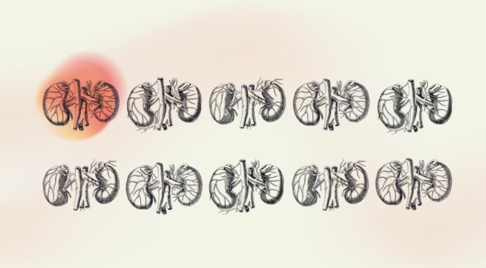 Malattia Renale Cronica, a lavoro su prevenzione e impatto economico