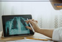 Patologie del torace, la diagnosi precoce è fondamentale