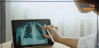 Patologie del torace, la diagnosi precoce è fondamentale