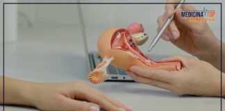 Comuni e quasi sempre benigni, come trattare i fibromi uterini