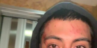 Aggressione omofoba a Roma, pestato mentre cammina col fidanzato