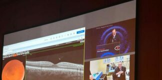 A “Macula 2025” eseguita una tomografia ottica computerizzata da remoto