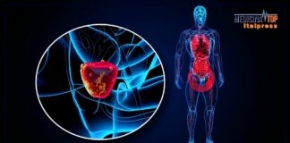 Tumore della prostata, in Italia 40 mila nuovi casi ogni anno