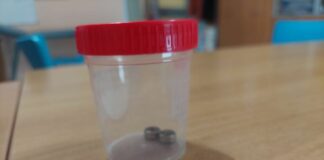 Ingerisce due batterie a bottone, bambina di un anno operata a Catania