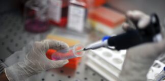 Scoperti codici del sistema immunitario per sospendere le cure da HIV