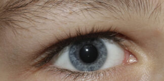 Vista Vision, l’eccellenza italiana nella cura dei disturbi visivi occhio azzurro