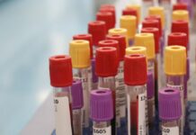 Seconda vittima per intossicazione da botulino in Sardegna, è una 62enne del Cagliaritano