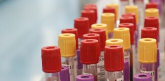 Botulino, dal 2001 al 2024 segnalati 1.276 casi in Italia